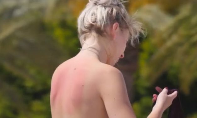 Zon komt eraan, dus topless